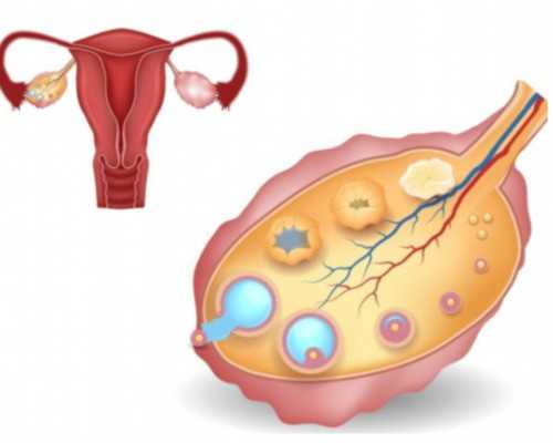 45岁女性受孕几率多大&供卵试管痛苦吗,阴茎癌疾病的预防方式有哪些