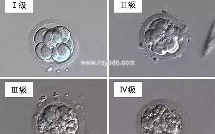 彭水42岁供卵生子_彭水48岁供卵还有机会吗_试管婴儿胚胎质量是怎么划分的
