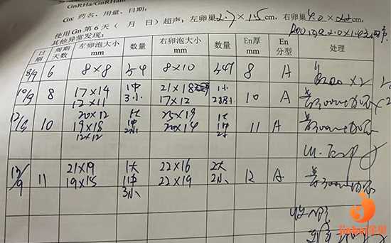 铁岭55岁做供卵试管成功率_记录一下我广州中山六院的试管婴儿经历-降调开始